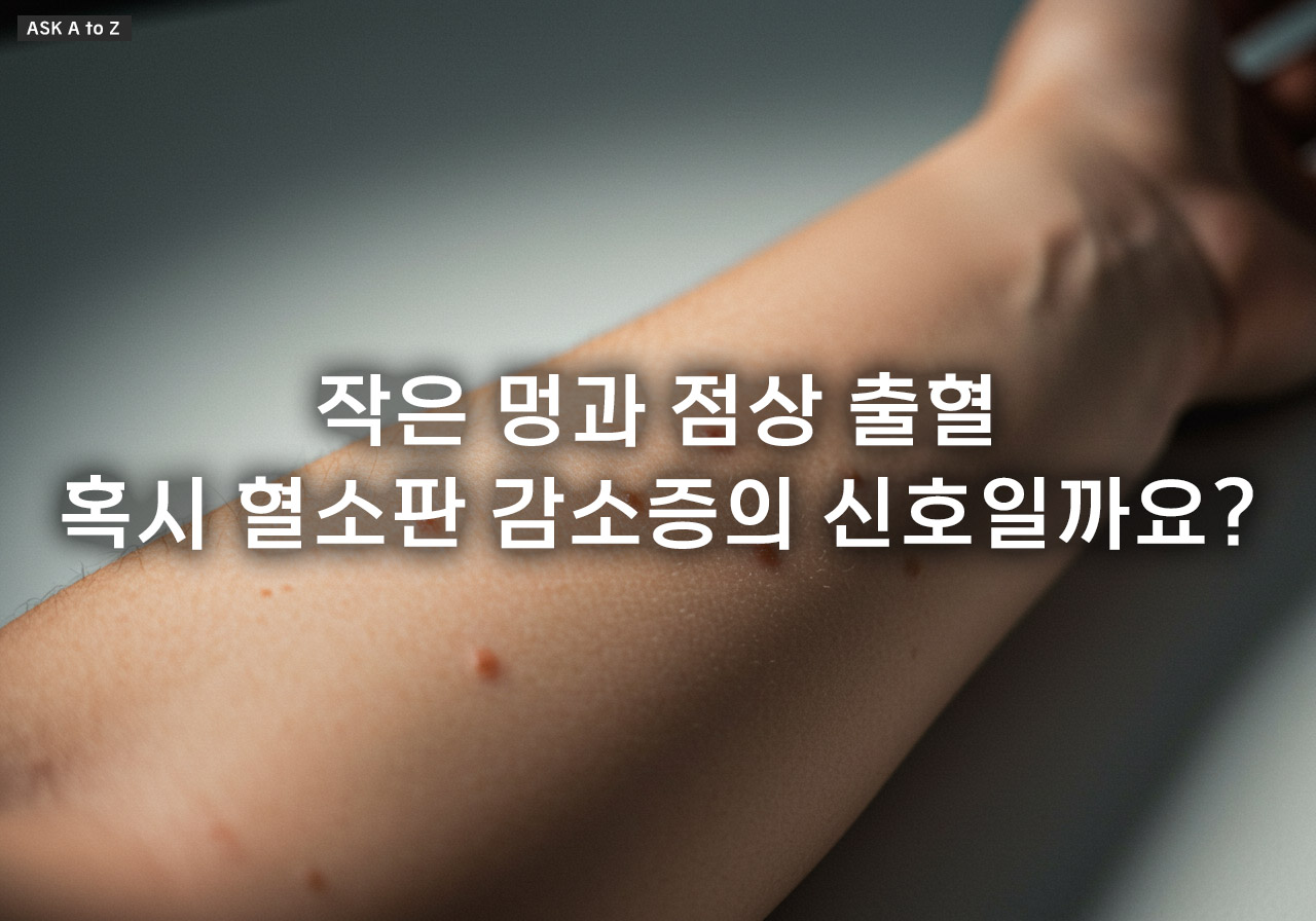 혈소판 수치가 낮으면 위험한가요? 감소증 증상, 원인, 올바른 대처법 총정리