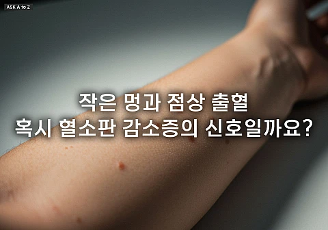 혈소판 수치가 낮으면 위험한가요? 감소증 증상, 원인, 올바른 대처법 총정리